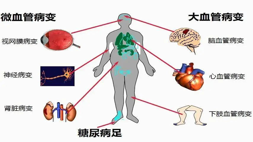 【醫(yī)院動(dòng)態(tài)】聯(lián)合國(guó)糖尿病日|糖尿病與幸福感